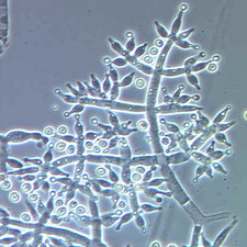 Hyphae of the Trichoderma harzianum fungus – Biological Control of Pythium Blight, Fusarium Wilt and Rhizoctonia